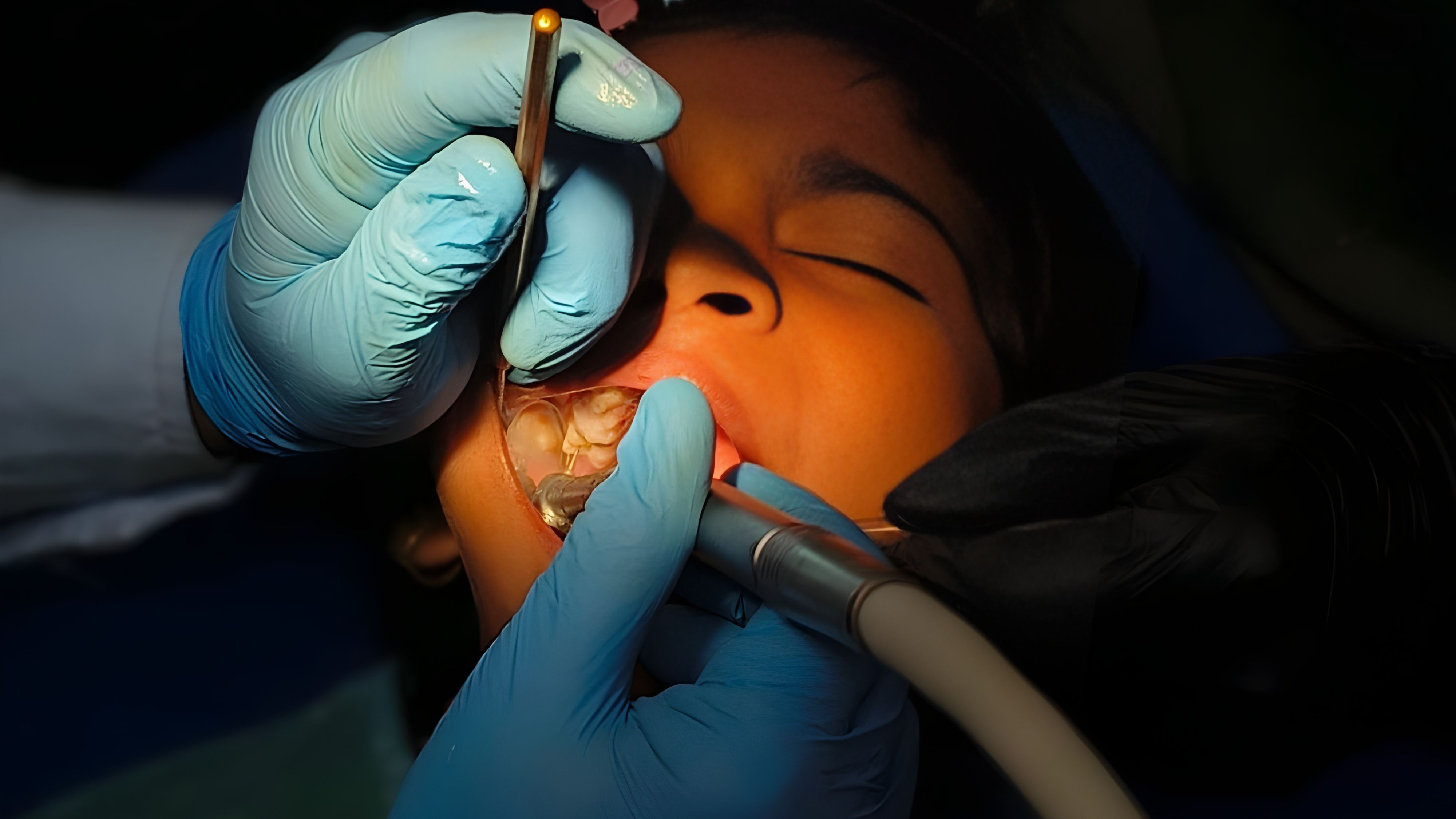 How to Avoid Cavities Home Remedies that Actually Work.